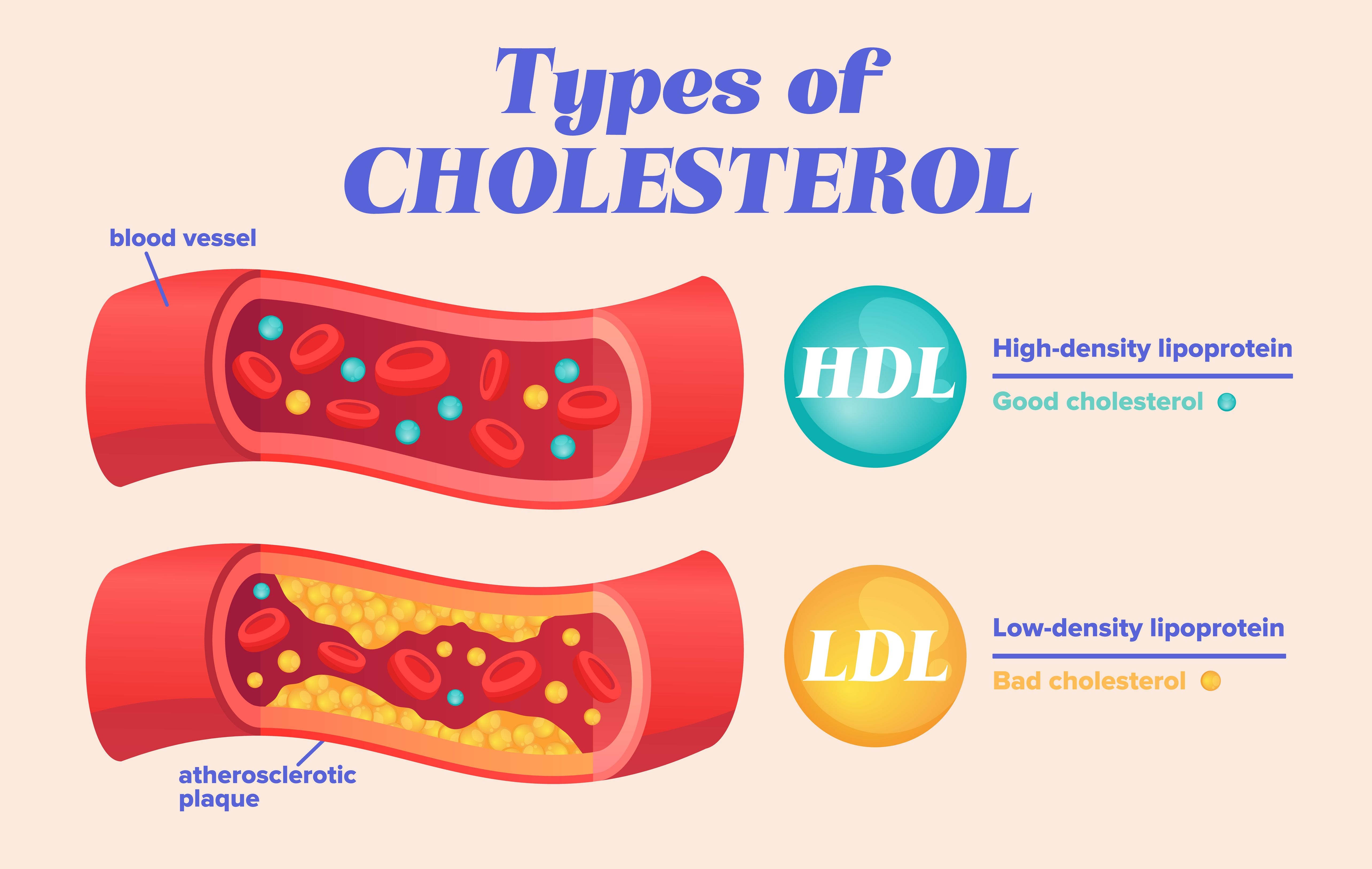 cholesterol