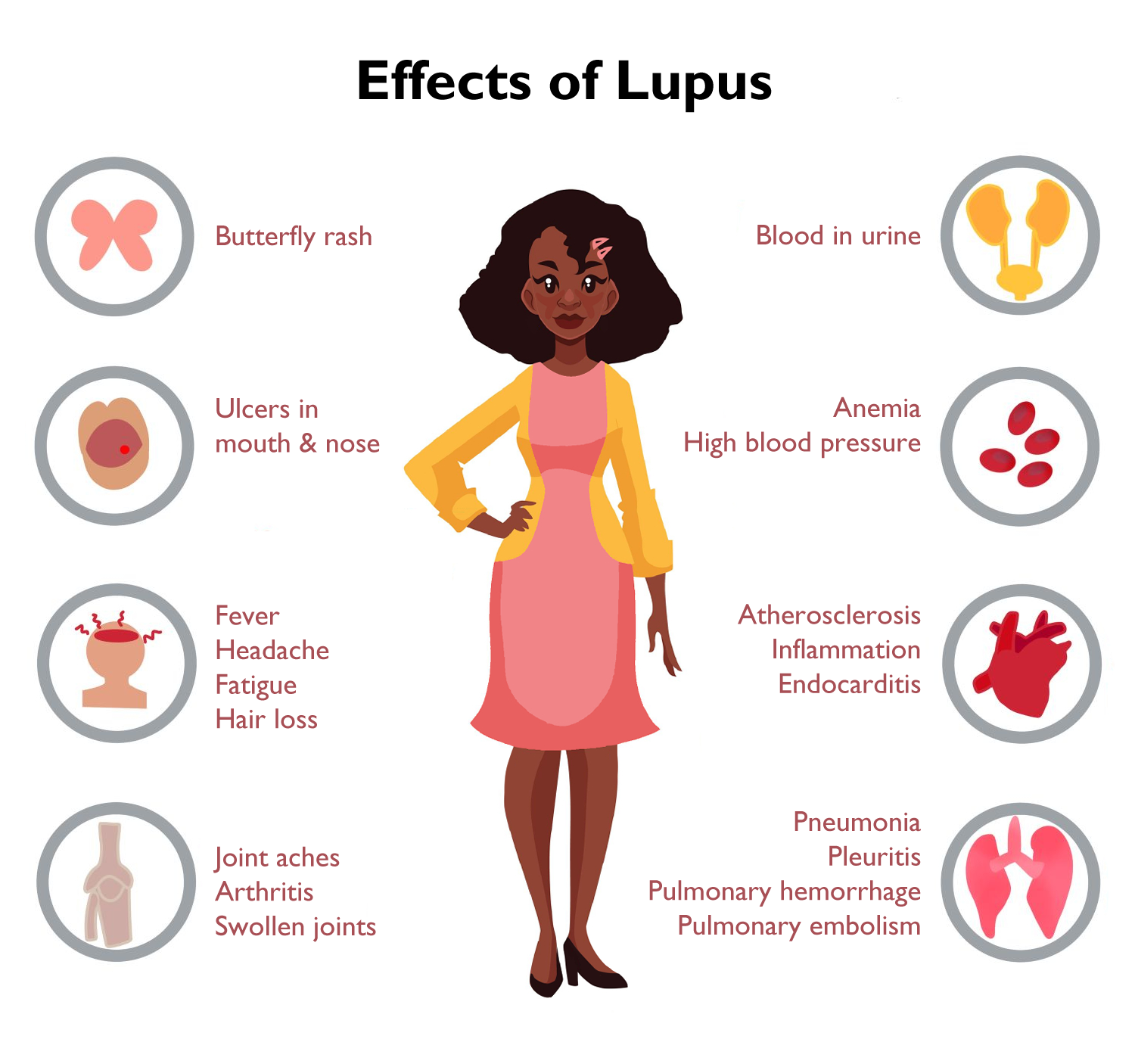 SLE and health